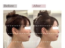 フロリール アザブジュウバン(FlorirAzabujuban)/リフトアップ専門ケア