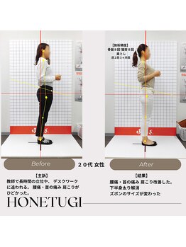 ほねつぎ総社 はりきゅう接骨院/成果/腰痛・肩こり