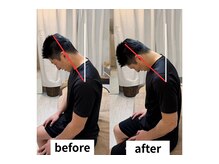 ヘルシールーム 六本木7丁目店(Healthy room)/before/after【肩こり/疲労感】