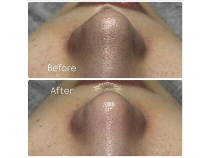 サラン スキンサロン(Sarang skin salon)の写真