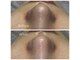 サラン スキンサロン(Sarang skin salon)の写真