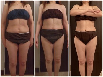 グレイスボディ ヨークタウン坂東店(Grace Body)/痩身ビフォーアフター