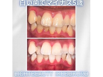 ライトビューティー 池袋店(LightBeauty)/症例写真