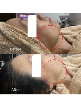 キーオブフェイス(Key of Face)/KF式小顔筋膜メソッド♪