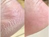 ふわふわかかとを手に入れる【スペシャル角質ケア60分】