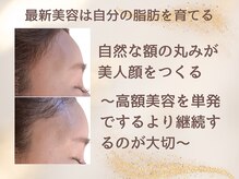 ワイズ 沖縄うるま院(Medical Y's)の雰囲気（刺さないヒアルで若見え顔を作る！ヒアリッチ注入で美しさを）