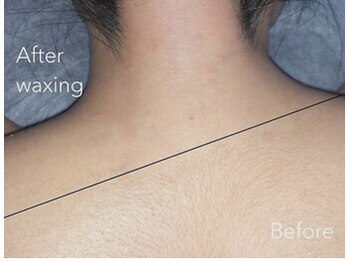 ハリウッドブロウリフト ワクシー 表参道店(HOLLYWOOD BROW LIFT WAXYYY.)/背中ワックス脱毛