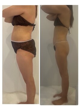 メゾン アンジュ(Maison Ange)/脚4回目/マイナス12キロ