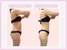 スリムライン 八戸店(The Slim Line)/before→after