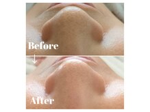 カラーリリー アンド ユン(Calla lily & yun)/