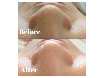 カラーリリー アンド ユン(Calla lily & yun)/