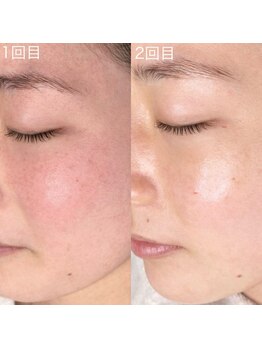 シーセブンビューティ(ccccccc b.)/ララピール