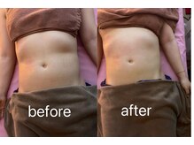 イーリバイブ/iNVYDOM MAX