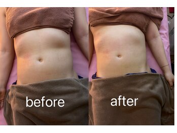 イーリバイブ/iNVYDOM MAX