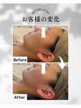 エムボーテ 太田店(M BEAUTE33)/顔筋小顔コルギ