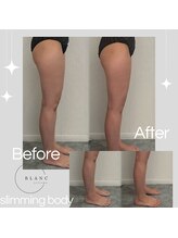 サロン ド ブラン アオヤマ(Salon de BLANC AOYAMA)/スリミングボディbefore・after