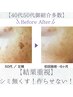 【シミケア】紫外線ダメージでてくる前に！お試し4980円/40.50代紹介多数