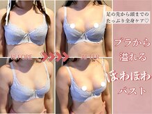 メデル(MEDEL)/ビフォーアフター