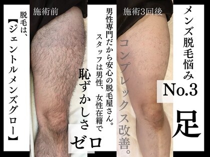 ジェントルメンズグロー(Gentlemen’s Glow)の写真
