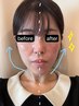 【お顔の引き締めに】EMSフェイシャル＋お悩み別選べるパック