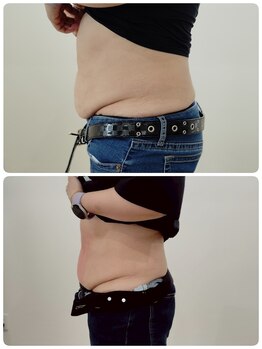 縁(en)/体重は増えても脂肪は減ってる!