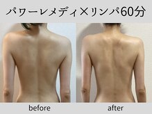 マーベル(MaaBelle)/パワーレメディ×リンパ60分