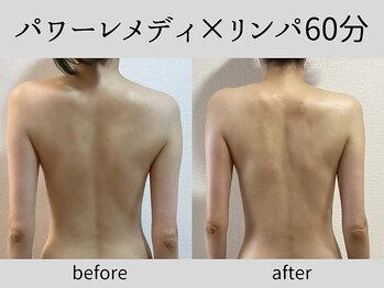 マーベル(MaaBelle)/パワーレメディ×リンパ60分