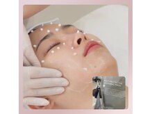 本場韓国肌育72時間肌管理2gに30万本のスピキュールエクソソーム