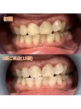 アデル 久留米(ADEL)/ビフォーアフター