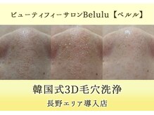 ビューティフィーサロン ベルル(Belulu)