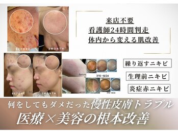 シェリー(Cherie)