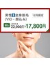 【12月限定】メンズ*全身脱毛(顔・VIO込)通常¥22,000→¥17,800