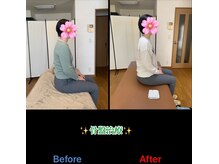 ヴィバランス(Vebalance)/当院自慢の骨盤矯正！