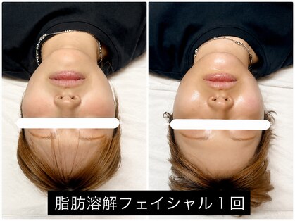ワイケー(yk)の写真