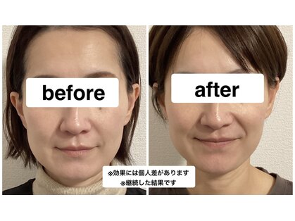 グリーン鍼灸整体院(green鍼灸整体院)の写真
