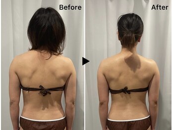 レミュー(Les mieux)/肩回りスッキリ！