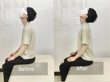 ナオル整体 国分寺院(NAORU整体)/30代男性【起床時の首の痛み】