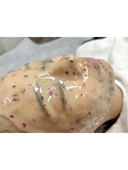 顔脱毛がしたい