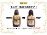 【毎月/限定３名】モニター３回券￥72,600→￥39,000(１回13,000円)
