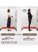 ほねつぎ総社 はりきゅう接骨院/成果/首肩・頭痛