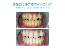 リラ(Lilas)の雰囲気（セルフホワイトニング導入★）