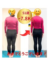 アロエ(Aloe)/ビフォーアフター　　50代