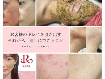 リベルテ(LIBERTE)