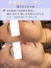 【ルディラ独自の光技術】光フェイシャル(シミ/くすみ）9980円