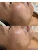 ココリール/くすみが取れ美白に