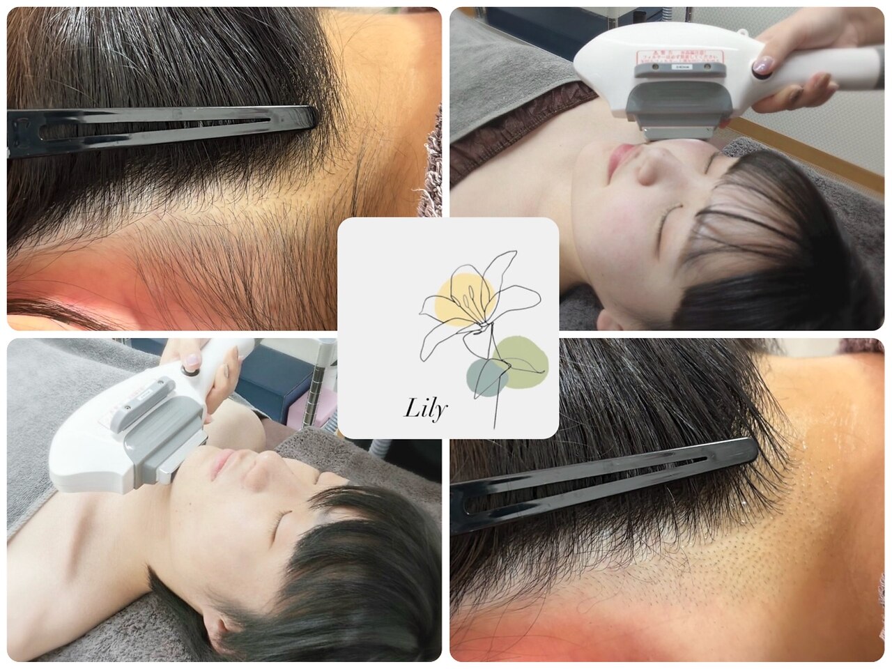 リリー(Lily)｜ホットペッパービューティー