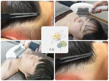 リリー(Lily)