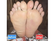 足つぼまーさん/冷えた足もポカポカ