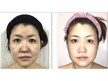小顔整体研究所 KSラボ 藤が丘店/
