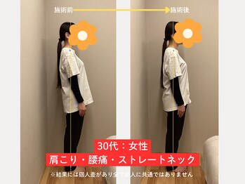 ソルム(solmu)/